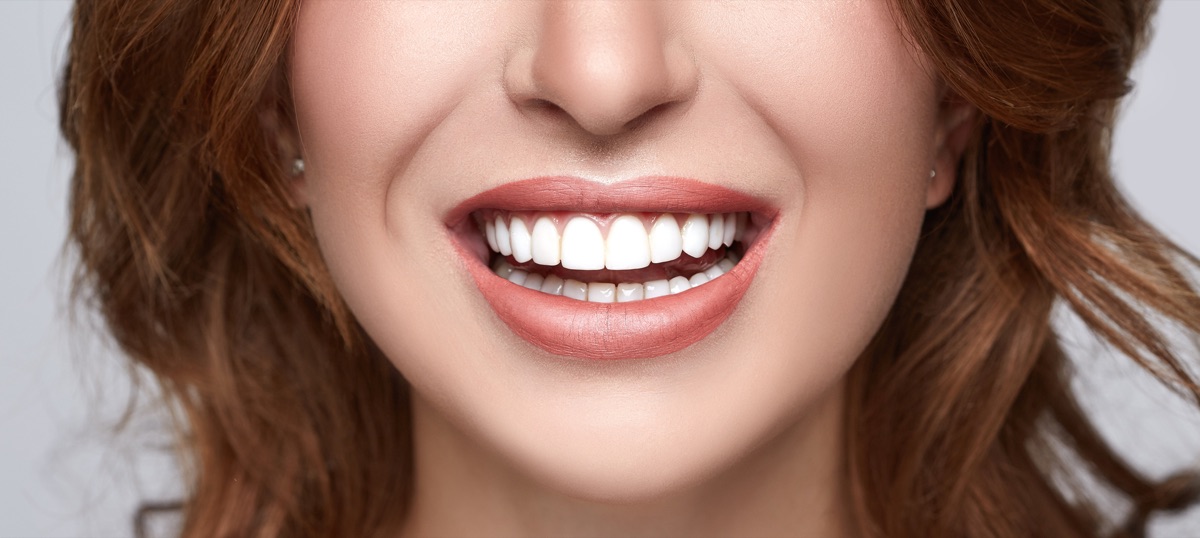 Un sourire après des soins esthétiques